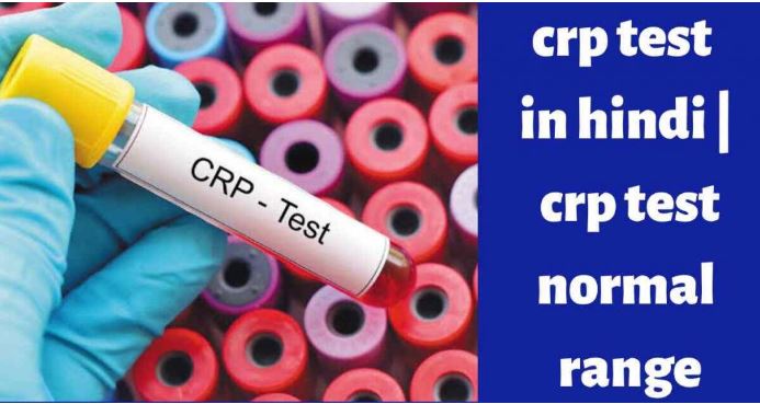 CRP Test In Hindi