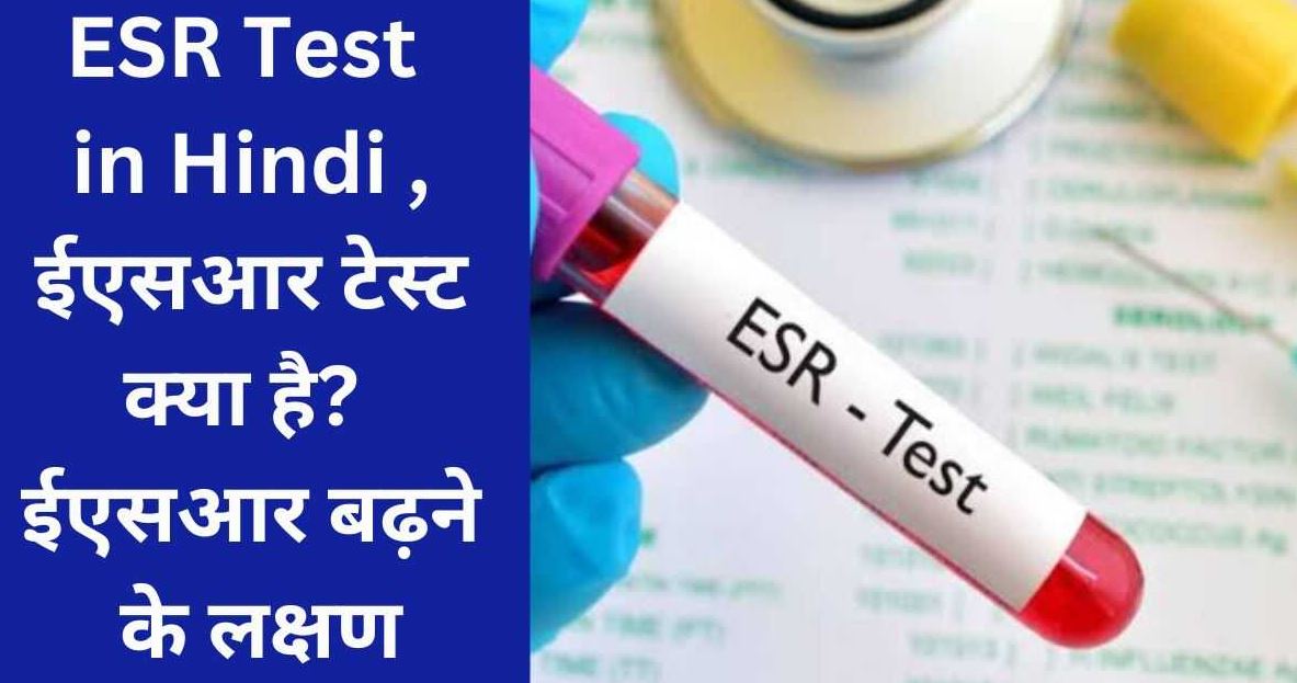 Home Remedies For ESR Test in Hindi