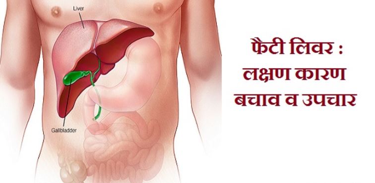 Home Remedies For Fatty Liver In Hindi