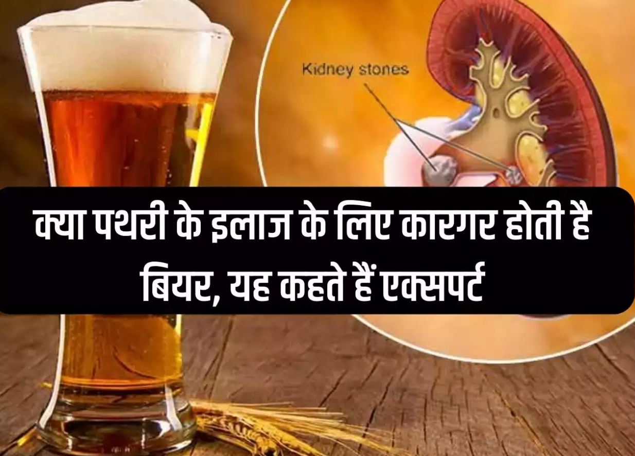 Treatment Of Kidney Stone With Beer