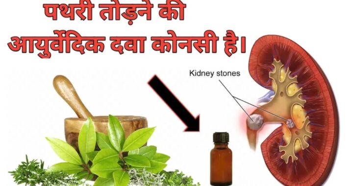 Ayurvedic Medicine For Kidney Stone